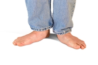 What Can Cause Flat Feet?