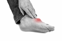 How Does Diet Relate to Gout?